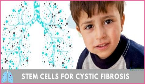Can you have 2 children with cystic fibrosis?